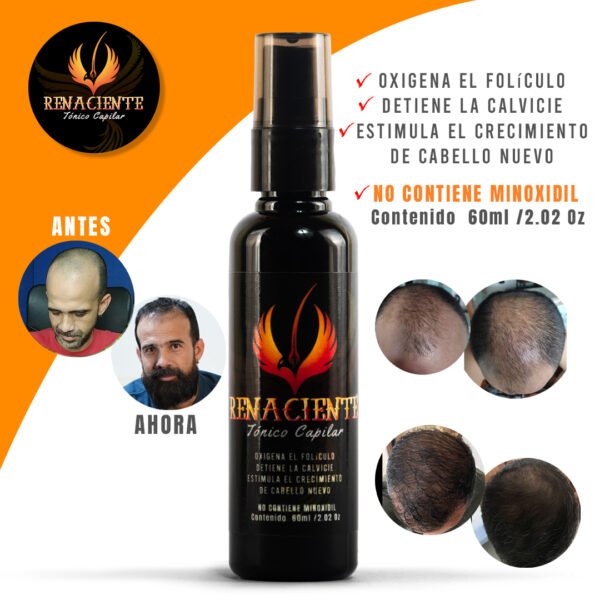 Renaciente x 1